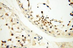 DNA polymerase beta Rabbit anti-Human, Mouse, Rat, Polyclonal, Proteintech