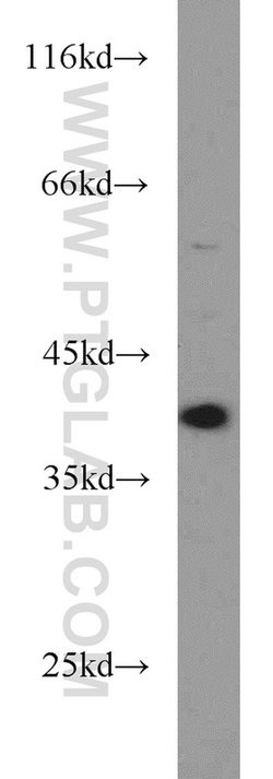 DNA polymerase beta Rabbit anti-Human, Mouse, Rat, Polyclonal, Proteintech 20 &mu;L; Unconjugated 