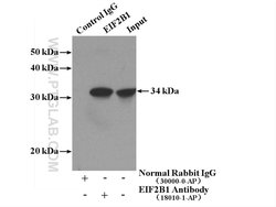 EIF2B1 Rabbit anti-Human, Polyclonal, Proteintech 20 &mu;L | Buy Online | Proteintech | Fisher Scientific