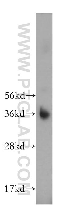 ATPAF1 Rabbit anti-Human, Mouse, Rat, Polyclonal, Proteintech 150 &mu;L | Buy Online | Proteintech Group Inc | Fisher Scientific
