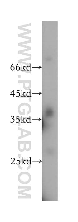 ATPAF1 Rabbit anti-Human, Mouse, Rat, Polyclonal, Proteintech 150 &mu;L | Buy Online | Proteintech Group Inc | Fisher Scientific