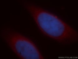 ICA1L Rabbit anti-Human, Mouse, Rat, Polyclonal, Proteintech 150 &mu;L;