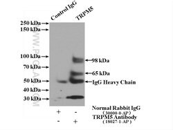 TRPM5 Rabbit anti-Human, Mouse, Rat, Polyclonal, Proteintech 150 &mu;L;