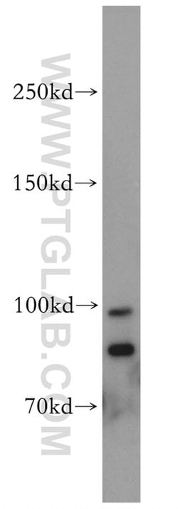 TRPM5 Rabbit anti-Human, Mouse, Rat, Polyclonal, Proteintech 150 &mu;L;