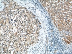 CGNL1 Rabbit anti-Human, Mouse, Polyclonal, Proteintech 150 &mu;L; Unconjugated:Antibodies,