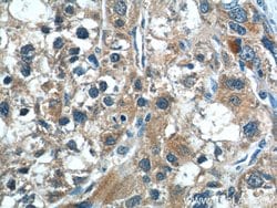 CGNL1 Rabbit anti-Human, Mouse, Polyclonal, Proteintech 150 &mu;L; Unconjugated:Antibodies,