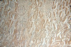 EDAR Rabbit anti-Human, Polyclonal, Proteintech:Antibodies:Primary Antibodies
