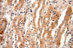 EDAR Rabbit anti-Human, Polyclonal, Proteintech:Antibodies:Primary Antibodies