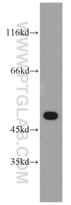 EDAR Rabbit anti-Human, Polyclonal, Proteintech:Antibodies:Primary Antibodies