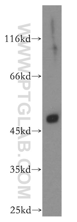 EDAR Rabbit anti-Human, Polyclonal, Proteintech:Antibodies:Primary Antibodies