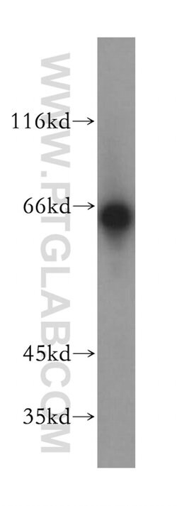 LGI2 Rabbit anti-Human, Mouse, Rat, Polyclonal, Proteintech 150 &mu;L;