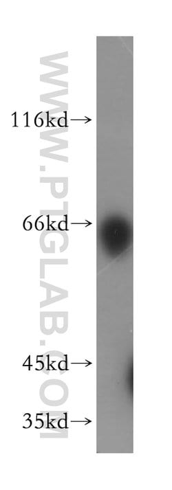 LGI2 Rabbit anti-Human, Mouse, Rat, Polyclonal, Proteintech 150 &mu;L;