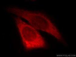 SERPINB13 Rabbit anti-Human, Mouse, Rat, Polyclonal, Proteintech:Antibodies:Primary