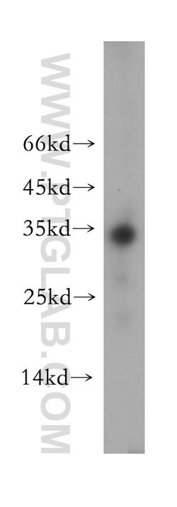 Neurotrophin 3 Rabbit anti-Human, Mouse, Rat, Polyclonal, Proteintech 150