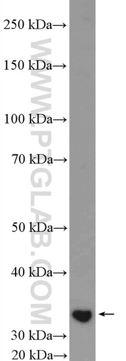 CENPP Rabbit anti-Human, Polyclonal, Proteintech 150 &mu;L; Unconjugated:Antibodies,