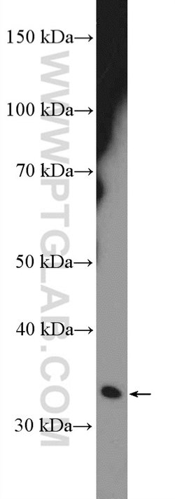 CENPP Rabbit anti-Human, Polyclonal, Proteintech 150 &mu;L; Unconjugated:Antibodies,