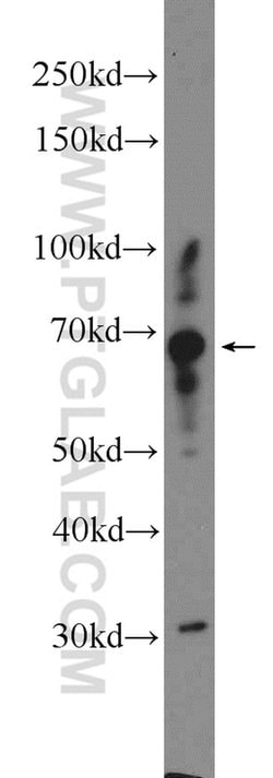 CPNE5 Rabbit anti-Human, Mouse, Rat, Polyclonal, Proteintech 150 &mu;L;