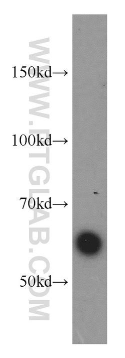TRAF3 Rabbit anti-Human, Polyclonal, Proteintech:Antibodies:Primary Antibodies