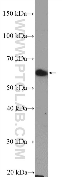 TRAF3 Rabbit anti-Human, Polyclonal, Proteintech:Antibodies:Primary Antibodies