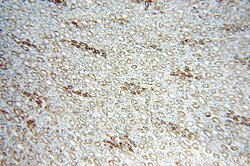 KLHL20 Rabbit anti-Human, Mouse, Rat, Polyclonal, Proteintech 150 &mu;L;