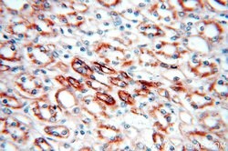 KLHL20 Rabbit anti-Human, Mouse, Rat, Polyclonal, Proteintech 150 &mu;L;