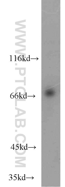 KLHL20 Rabbit anti-Human, Mouse, Rat, Polyclonal, Proteintech 150 &mu;L;