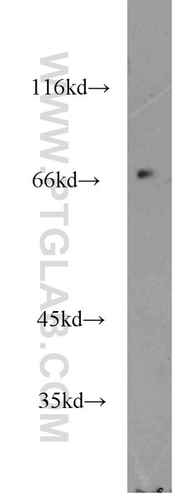KLHL20 Rabbit anti-Human, Mouse, Rat, Polyclonal, Proteintech 150 &mu;L;