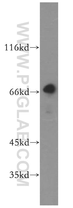 KLHL20 Rabbit anti-Human, Mouse, Rat, Polyclonal, Proteintech 150 &mu;L;