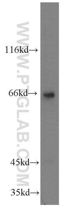 KLHL20 Rabbit anti-Human, Mouse, Rat, Polyclonal, Proteintech 150 &mu;L;