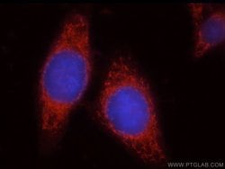 Uroguanylin Rabbit anti-Human, Mouse, Rat, Polyclonal, Proteintech 150