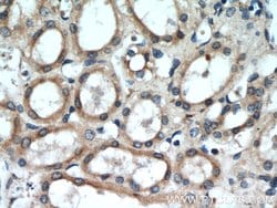 Uroguanylin Rabbit anti-Human, Mouse, Rat, Polyclonal, Proteintech 150