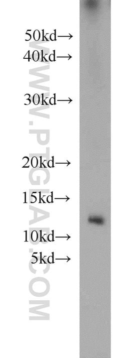 Uroguanylin Rabbit anti-Human, Mouse, Rat, Polyclonal, Proteintech 150