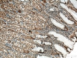Uroguanylin Rabbit anti-Human, Mouse, Rat, Polyclonal, Proteintech 150
