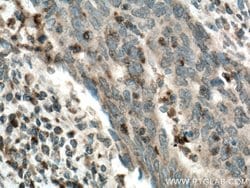 Uroguanylin Rabbit anti-Human, Mouse, Rat, Polyclonal, Proteintech 150