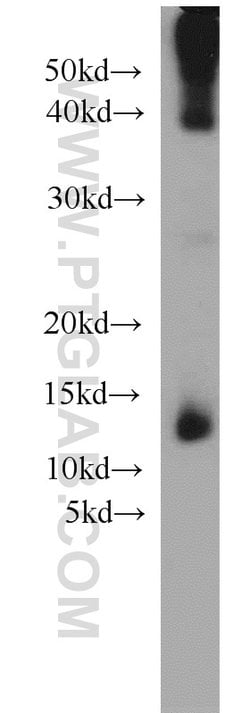 Uroguanylin Rabbit anti-Human, Mouse, Rat, Polyclonal, Proteintech 150