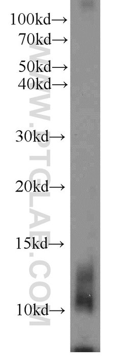Uroguanylin Rabbit anti-Human, Mouse, Rat, Polyclonal, Proteintech 150