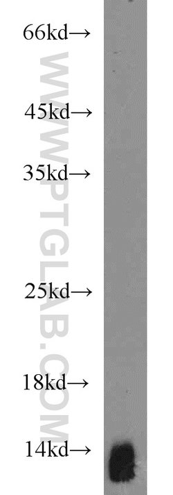 Uroguanylin Rabbit anti-Human, Mouse, Rat, Polyclonal, Proteintech 150