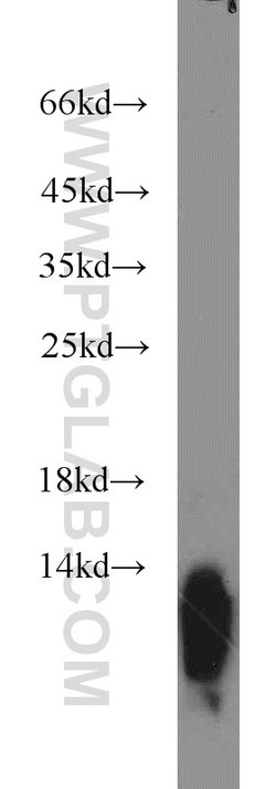Uroguanylin Rabbit anti-Human, Mouse, Rat, Polyclonal, Proteintech 150