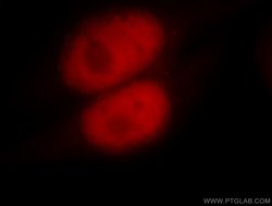 MSH6 Rabbit anti-Human, Mouse, Rat, Polyclonal, Proteintech:Antibodies:Primary