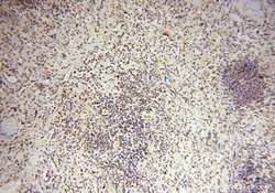 MSH6 Rabbit anti-Human, Mouse, Rat, Polyclonal, Proteintech:Antibodies:Primary