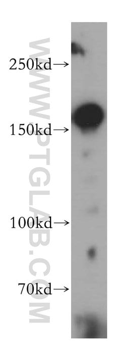 MSH6 Rabbit anti-Human, Mouse, Rat, Polyclonal, Proteintech:Antibodies:Primary
