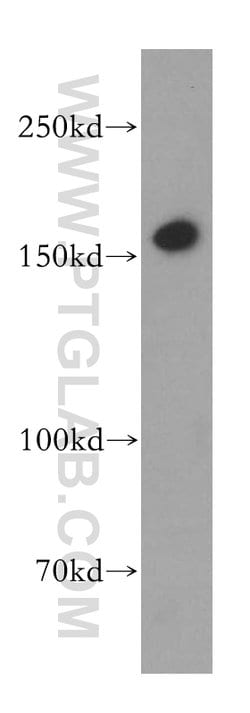 MSH6 Rabbit anti-Human, Mouse, Rat, Polyclonal, Proteintech:Antibodies:Primary