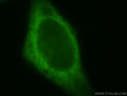 FARSA Rabbit anti-Human, Mouse, Rat, Polyclonal, Proteintech:Antibodies:Primary