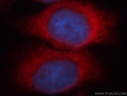 FARSA Rabbit anti-Human, Mouse, Rat, Polyclonal, Proteintech:Antibodies:Primary