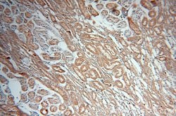 FARSA Rabbit anti-Human, Mouse, Rat, Polyclonal, Proteintech:Antibodies:Primary