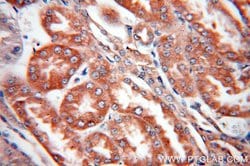 FARSA Rabbit anti-Human, Mouse, Rat, Polyclonal, Proteintech:Antibodies:Primary