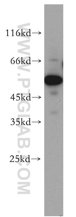 FARSA Rabbit anti-Human, Mouse, Rat, Polyclonal, Proteintech:Antibodies:Primary