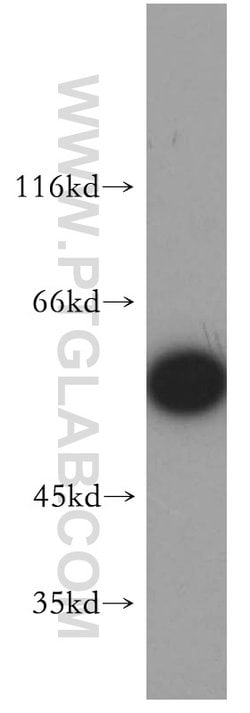 FARSA Rabbit anti-Human, Mouse, Rat, Polyclonal, Proteintech:Antibodies:Primary