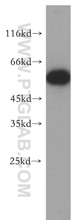 FARSA Rabbit anti-Human, Mouse, Rat, Polyclonal, Proteintech:Antibodies:Primary