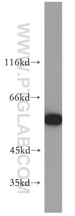 FARSA Rabbit anti-Human, Mouse, Rat, Polyclonal, Proteintech:Antibodies:Primary